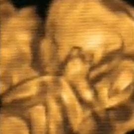 VIDEO – Cum arata o ecografie 4D