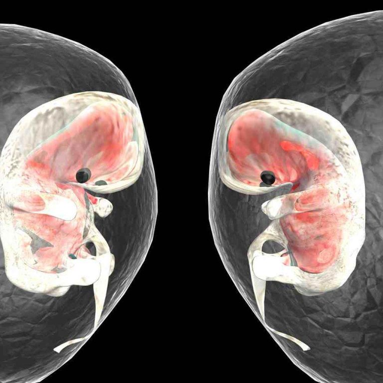 Fertilizarea in vitro