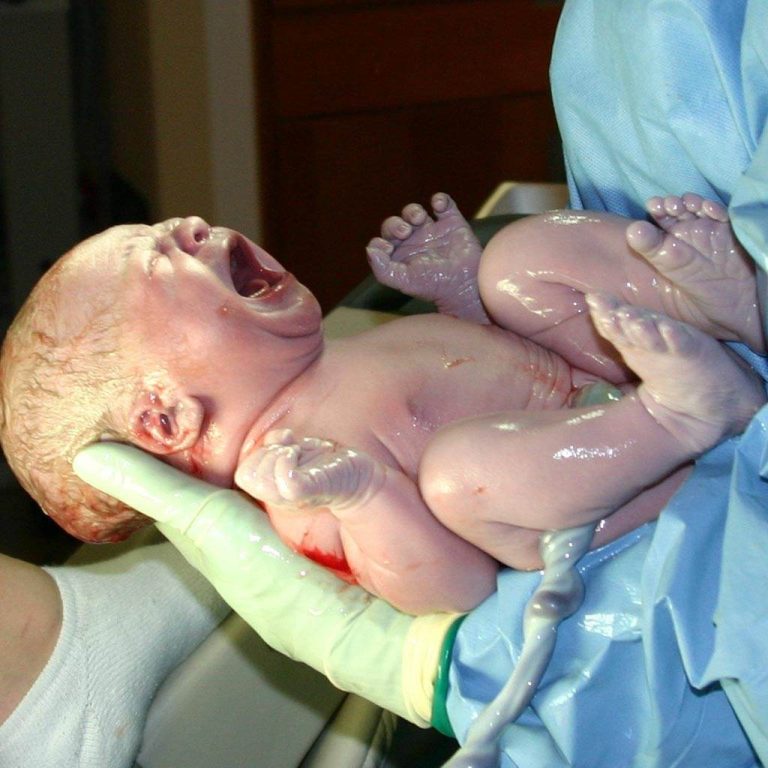 Infectiile la bebelus