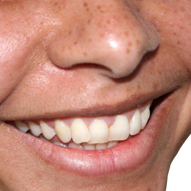 Sanatatea dentara in sarcina
