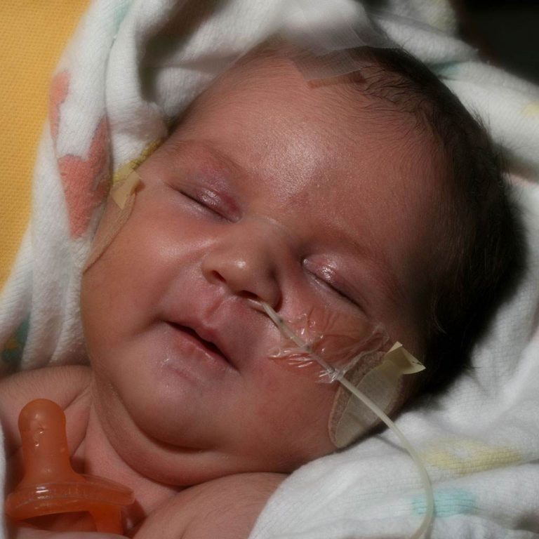 Prematurul si sansele de supravietuire