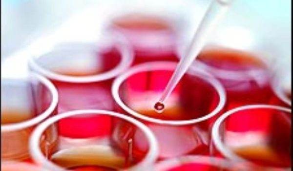 Recoltarea de celule stem din sangele placentar