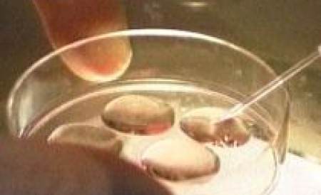 Celulele stem ar putea produce ovule necesare tratarii infertilitatii