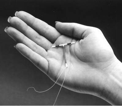 Contraceptia dupa nastere – steriletul