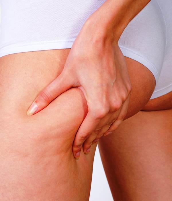 3 remedii naturale împotriva celulitei