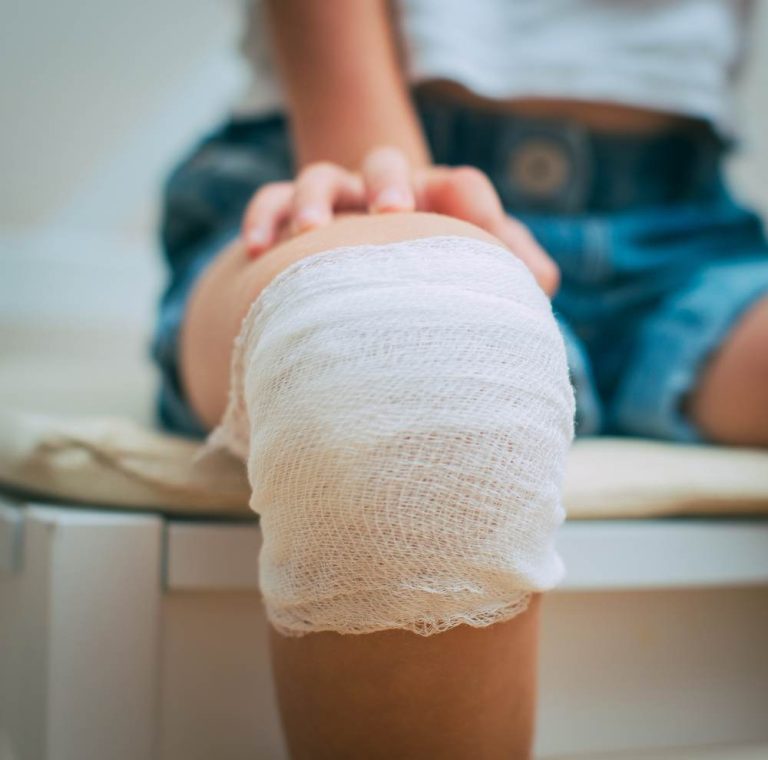 Mici accidente – cum le tratezi?