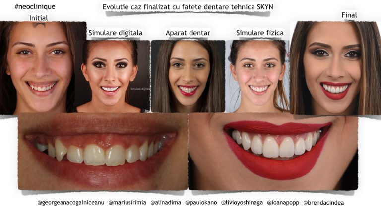 Estetică dentară în timp real