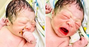 Un bebeluș a venit pe lume cu un „suvenir” în mână: STERILETUL mamei sale – FOTO VIRAL