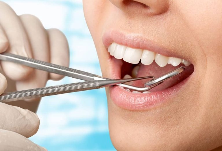 Ce se ascunde în spatele gingiilor vineții?